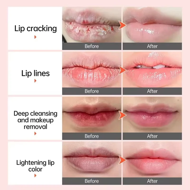 Lippenbalsam mit dunklem Rauch entfernen, aufhellendes Melanin, bleichendes Glanzöl, Lippen, rosa Lippenstift, Peeling, verblassende Lippenlinien, nährt die Lippenpflege
