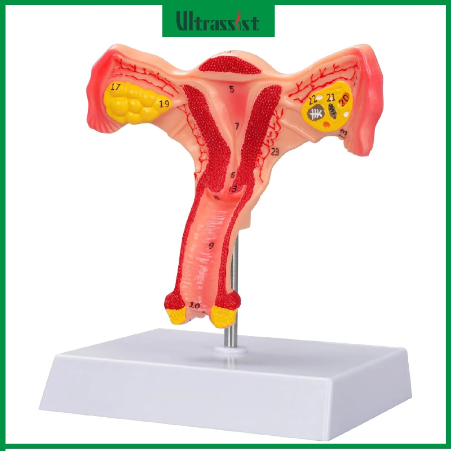 

Ultrassist Human Uterus & Ovary Anatomical Model Female Reproductive Gynecological Teach Tool for Medic Education Demonstration