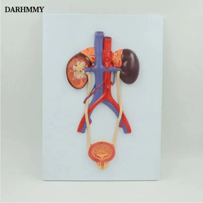 DARHMMY Human Anatomy Bladder Catheterization Renal Urinary System Model Kidney Arteriovenous Model Medical Teaching