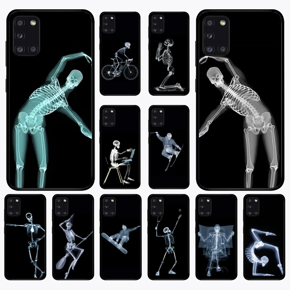 

Radiological Human Organs Skeleton Phone Case For Samsung A 10 11 12 13 20 21 22 30 31 32 40 51 52 53 70 71 72 73 91 13 Shell