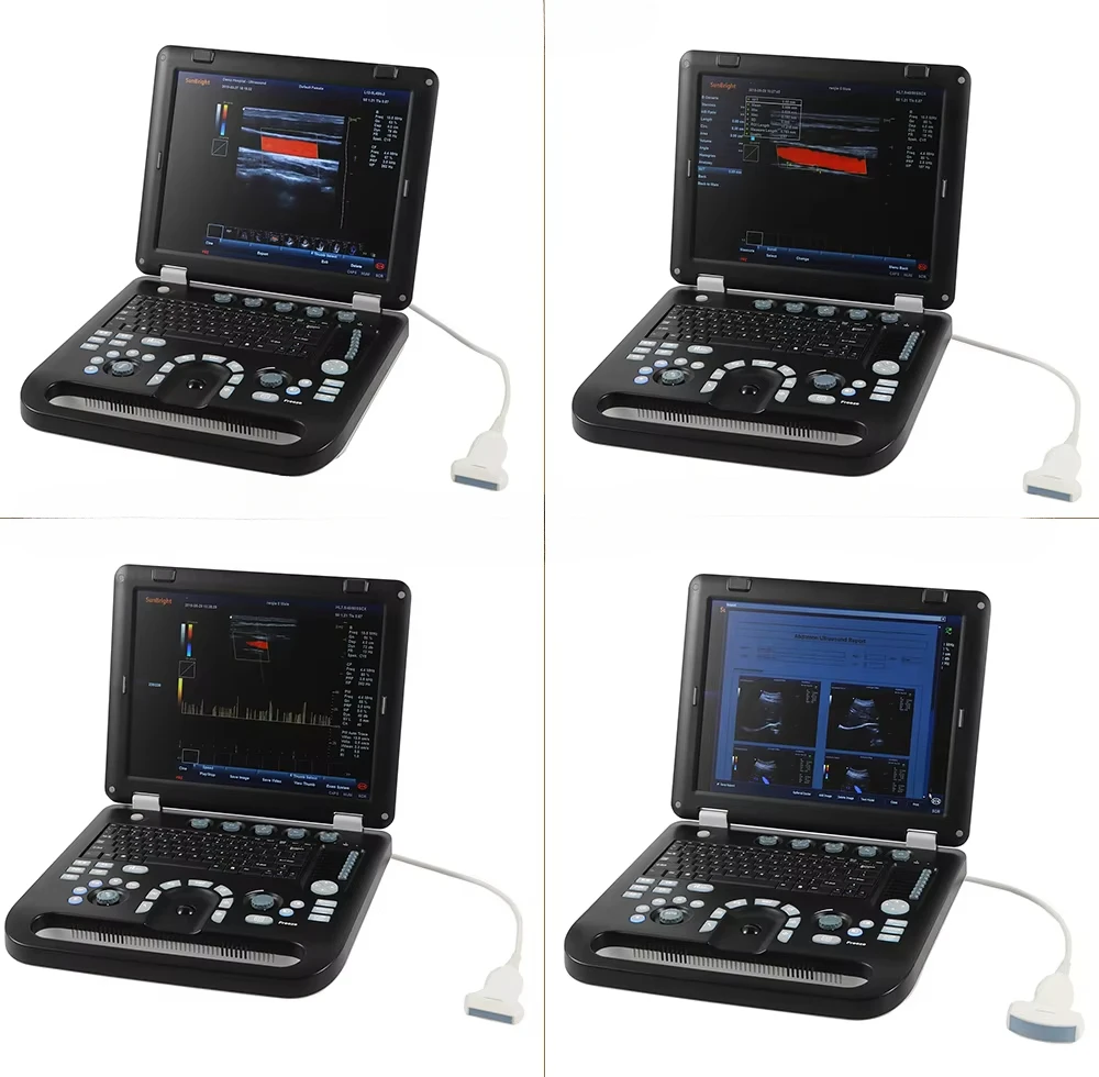 Medical Equipment Large Screen Diagnostic Ultrasound Machine Trolley Color Doppler Ultrasound Scan