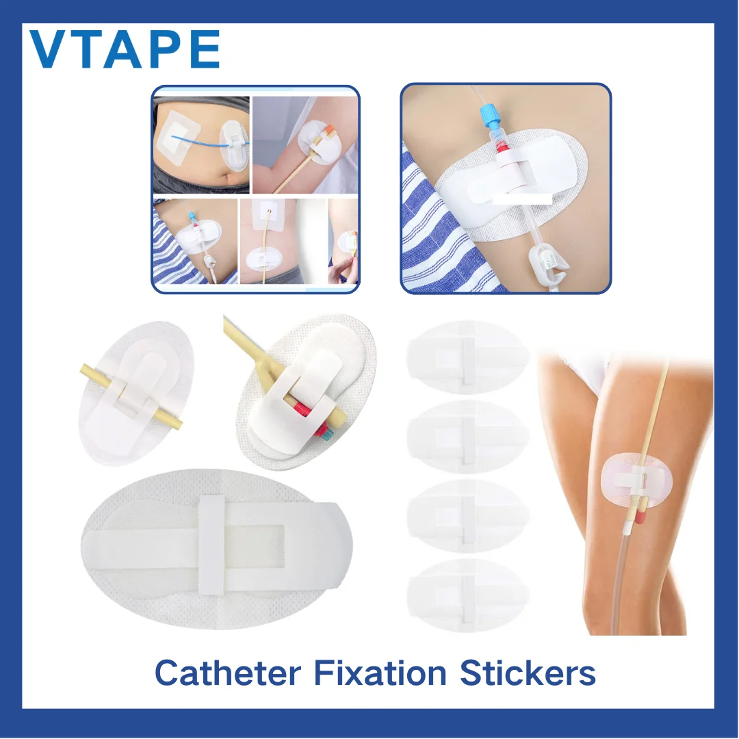 30 Pack Catheter Holder Tube Sticker Leg Device Stabilization Urine Fixation Urinary Fixing Tape Band Anchor Stickers Straps