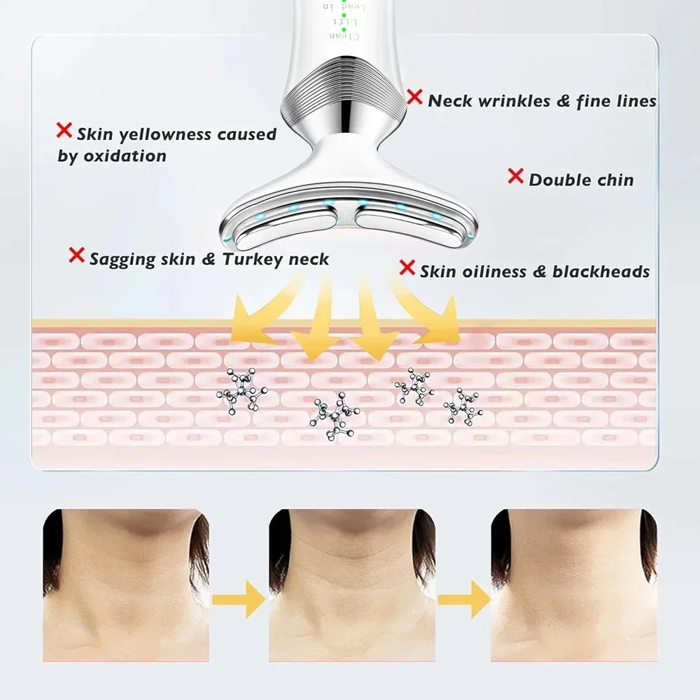 EMS Urządzenie do pielęgnacji twarzy szyi Maszyna do liftingu twarzy Napinanie skóry Zmniejszenie podwójnego podbródka Przeciwzmarszczkowe usuwanie Lifting Masażer do pielęgnacji skóry