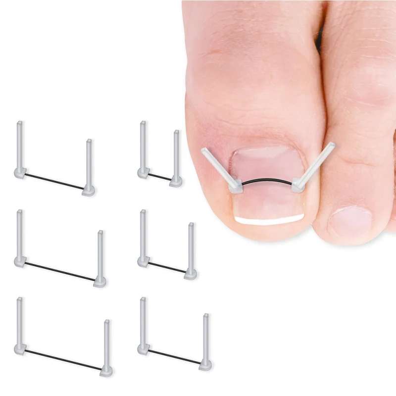 Ingrown Toenail Correction Wire Foot Care Tools Professional Treatment Recover Embed Toe Nail Pedicure Straightening Toe Tools