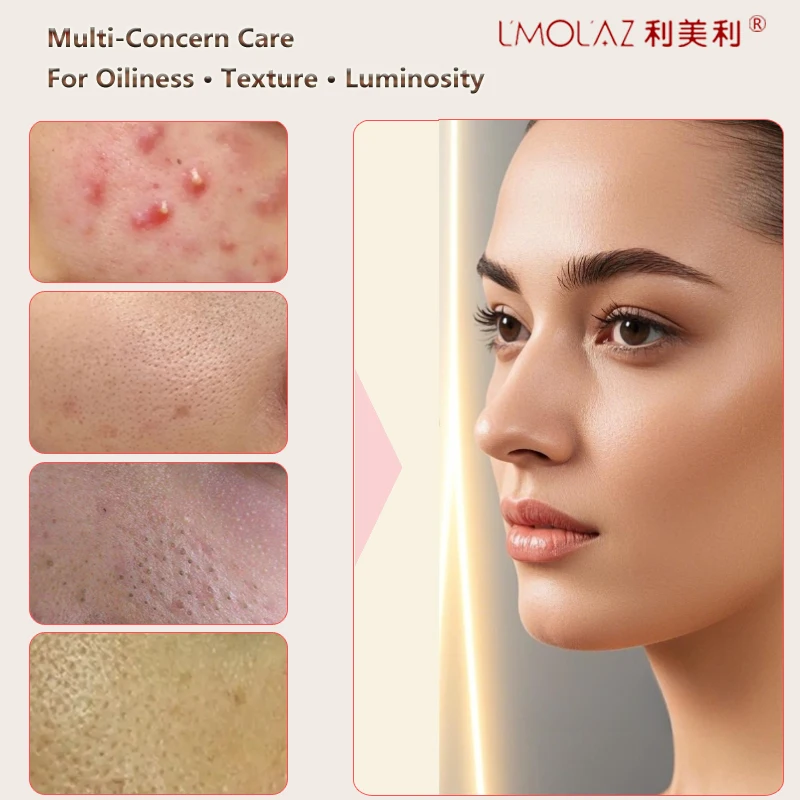 lmolaz Clarifying Facial Serum - Oil Control & Acne Treatment for Pore Refining and Skin Smoothing