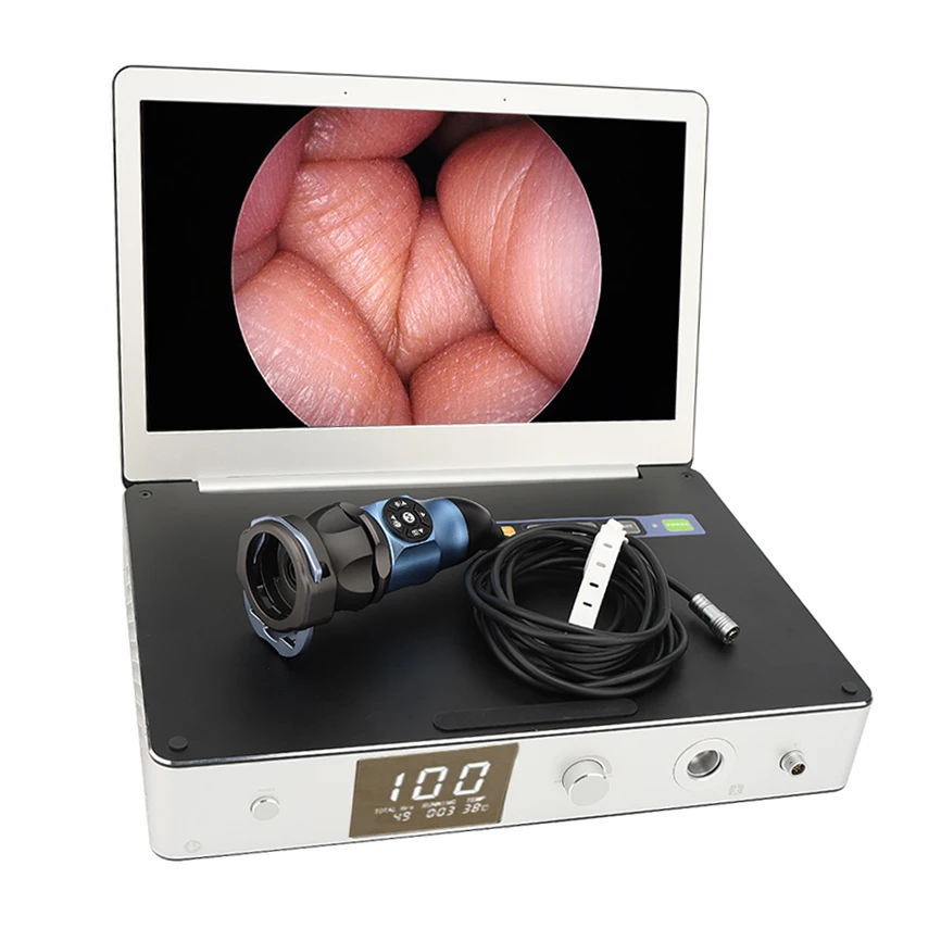 Integrated Endoscopic Camera System, 11.6-inch USB HDMI Full HD Endoscopic Camera System for Otolaryngology