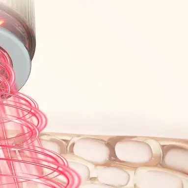 Mikrostrom-Gesichtsmassagegerät, Hautstraffung, 4 Farben, LED-Lichttherapie, Vakuum-Schröpfen, Facelifting-Gerät, schlankmachendes Gesicht