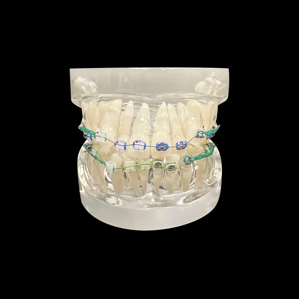 Dental Typodont modello di denti ortodontici con staffe in metallo e ceramica bretelle fascette a catena modelli di trattamento odontoiatrico con filo ad arco