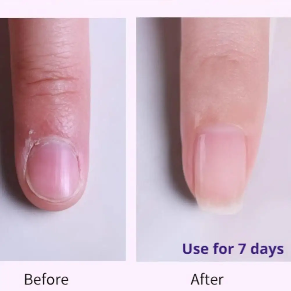 Stylo à huile pour cuticules 3 en 1, nourrissant, réparer les ongles, prévient la casse, Portable pour tous les ongles, entretien quotidien, Absorption rapide, améliore les soins