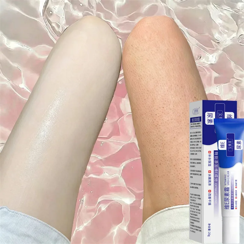Keratosis Pilaris Repair Treatment Cream Exfoliating Removal Chicken Skin Cleaning Acne Spots Moisturizing Smooth Body Skin Care