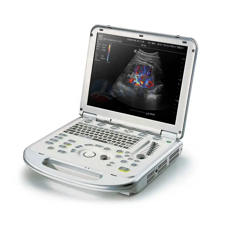 Mindray Professional Portable 3d/4d Color Doppler Ultrasound Machine,Ecografo Mindray M5 M7 M9