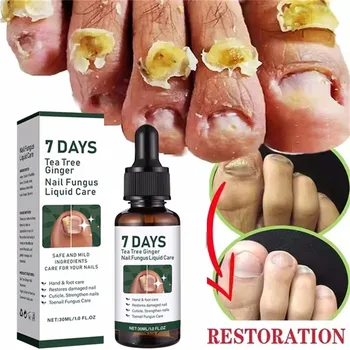 Fungal Nail Care Serum 1