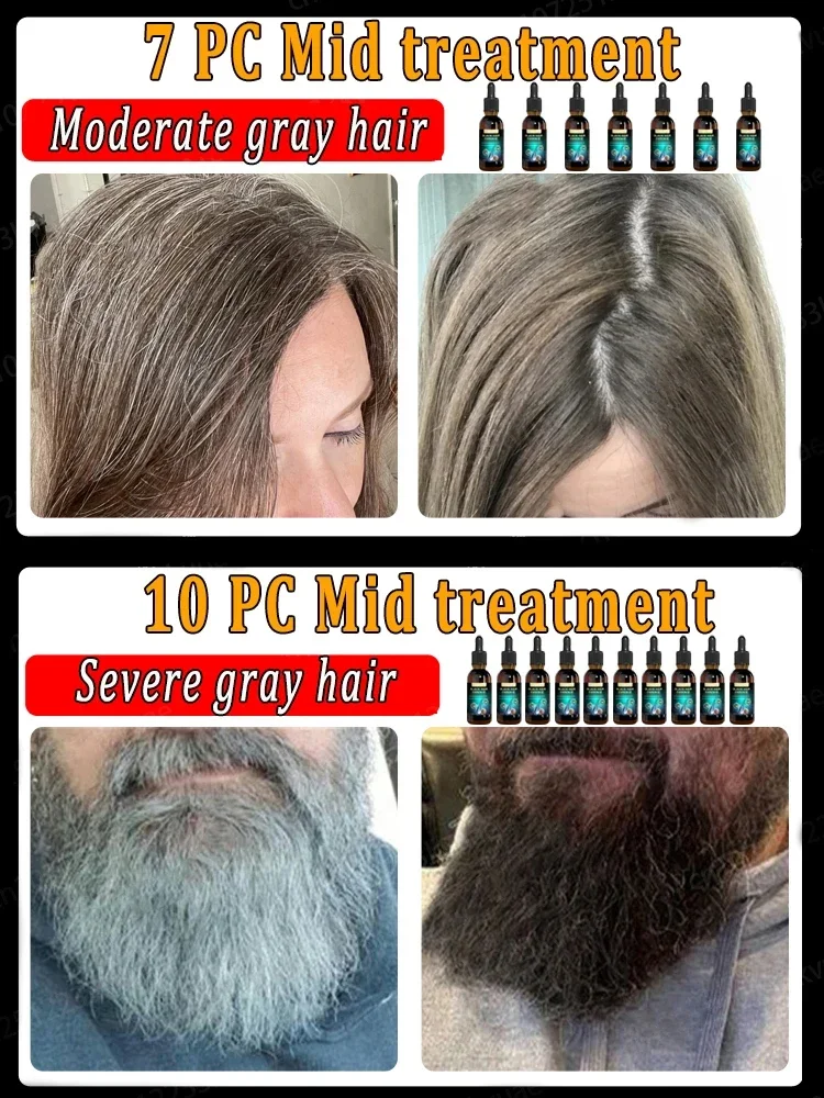 Anti-Grey Hair Essence Serum, Restaurar, Cor Natural, Restaurar, Saudável, Branco para Preto