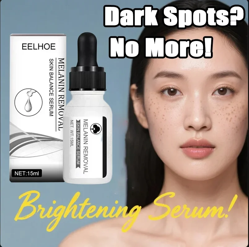 

Whitening Freckles Face Serum Remove Melasma Dark Spots Corrector Cream Fade Melanin Acne Anti-Aging Brighten Skin Care