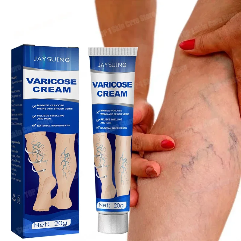 【 Effective within 7 days 】 Painless spider vein pain, effective varicose vein removal cream