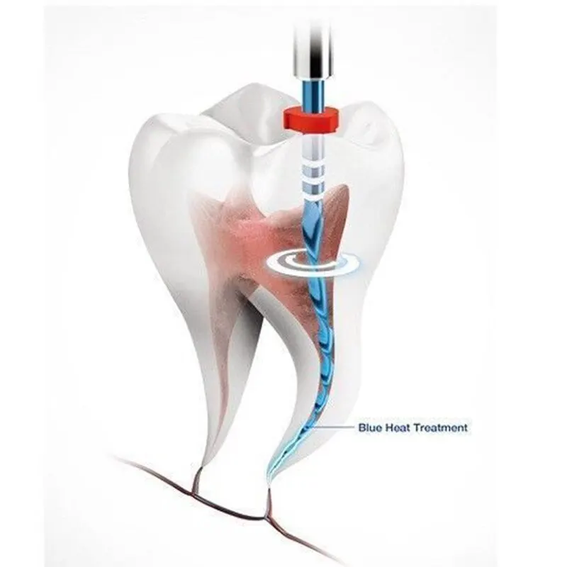 Arquivo ativado por calor dental para tratamento do canal radicular, recuperável em água, ferramenta odontológica rotativa, 6 PCs/box