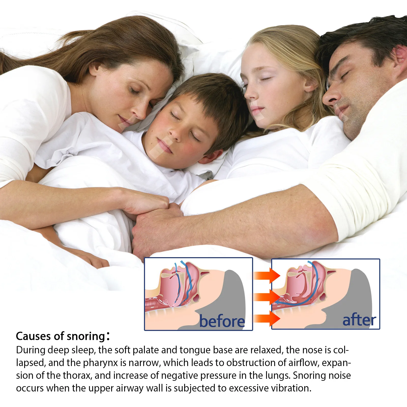South Moon Anti Snoring Mouth Tape Kids Adult Improve Nighttime Sleeping Less Mouth Breath Reduce Sore Throat Stop Snore Sticker