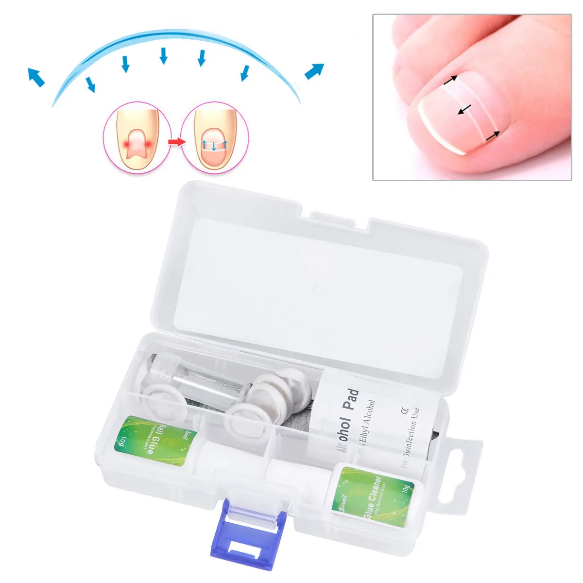 

1 Set Nail Toe Correction Ingrown Toe Nail Lifter Directional Patch Fixer Recover Tool with Standard