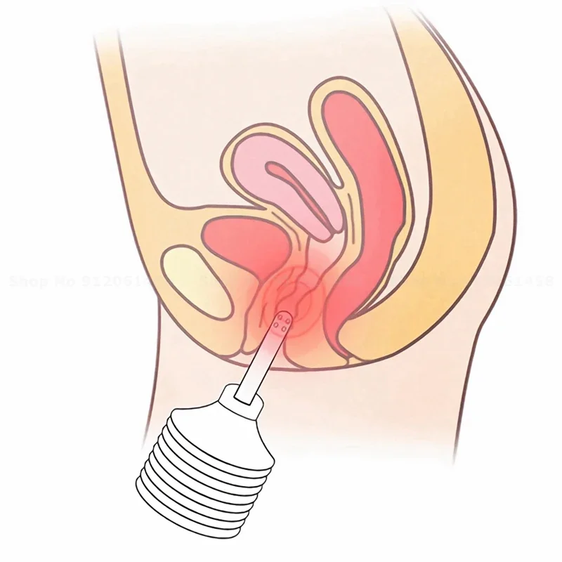 อุปกรณ์ทำความสะอาดทวาร180มล. ของเล่นเซ็กซี่สำหรับผู้ชายเซ็กซ์ทอยสำหรับผู้หญิงปลั๊กทวารหนักแบบเต็มตัว