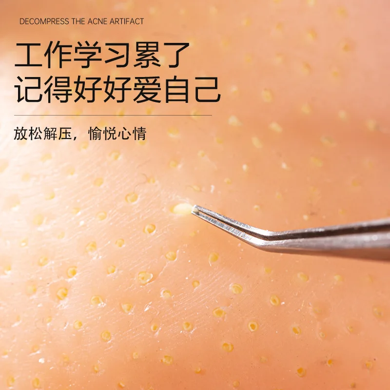 Stress relief, pimple squeeze, blackhead extraction, simulated big-head model, pimple silicone doll gift view 3