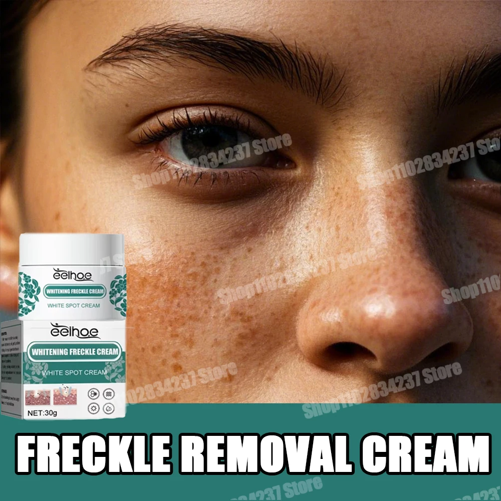 

Крем для удаления веснушек разбавляет меланин и различные пятна на лице солнечных пятен и веснушек.