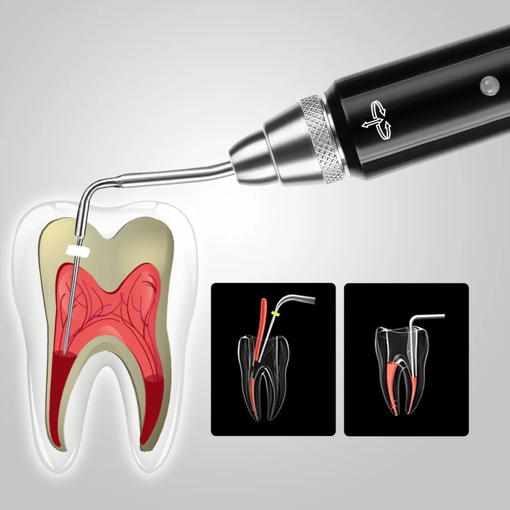 Azdent dentystyczny bezprzewodowy bezprzewodowy System obturacji gutaperka Endo podgrzewany długopis z 2 końcówkami 3-sekundowe narzędzie szybkie