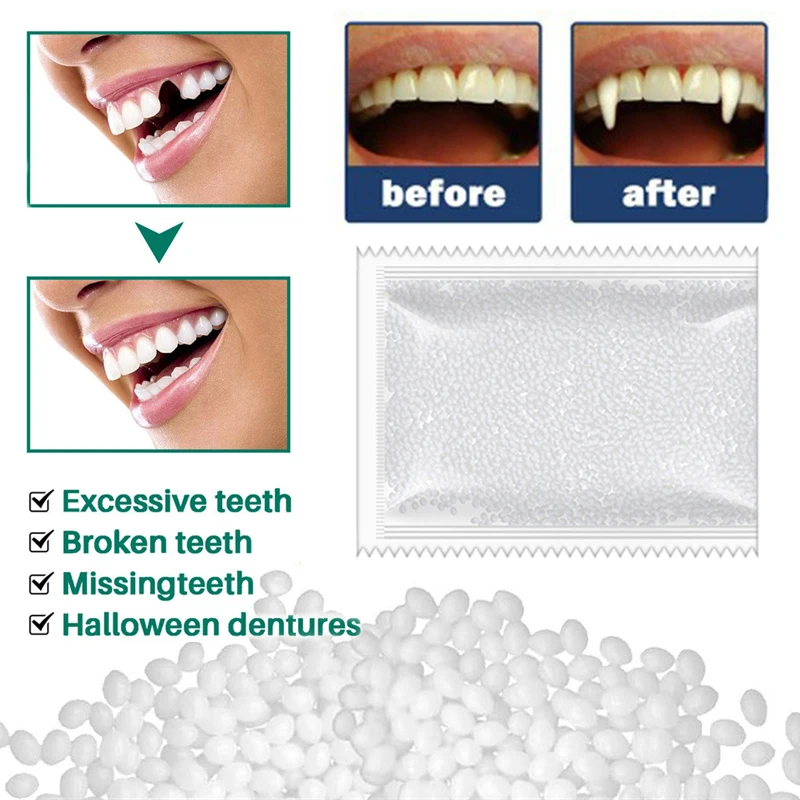 

10-100g Solid Denture Glue Moldable False Teeth Resin Glue Temporary Teeth Repair Filling Glue DIY Halloween Denture Supplies