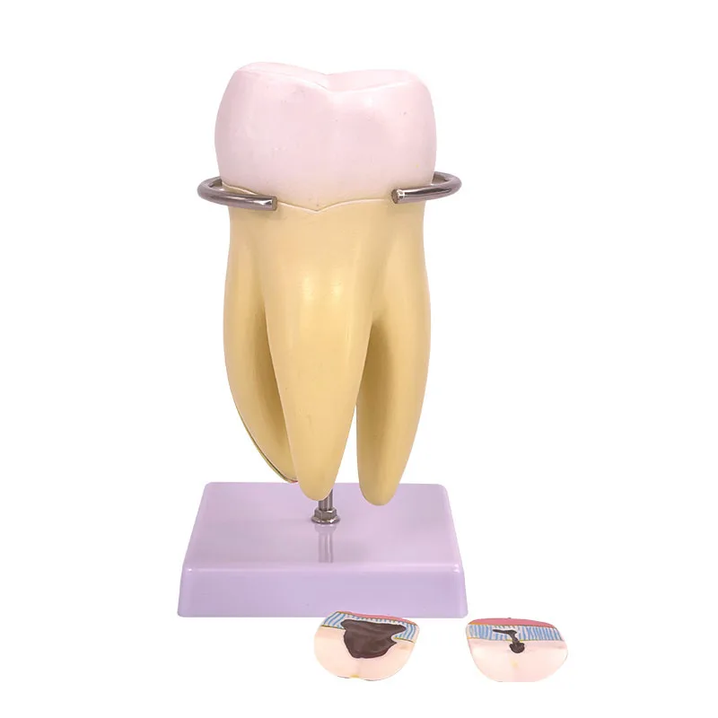 

Detachable Large Molar Model PVC Portable And Practical Vivid Mortar Tooth Anatomical Model Visual Teaching Mold