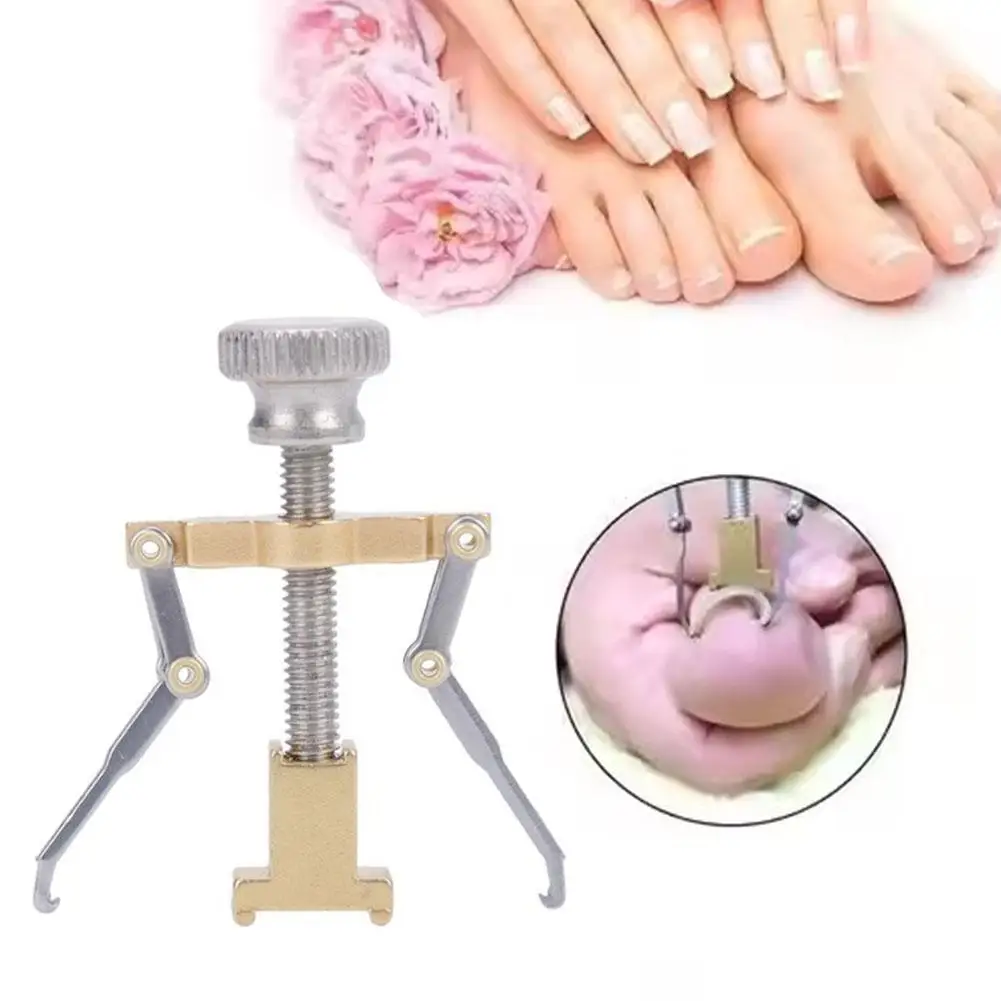 Ingrown Toenail Lifter Tool Stainless Steel Nail Correction Device for Ingrown Nail Repair Pedicure Tool Foot Care Accessories