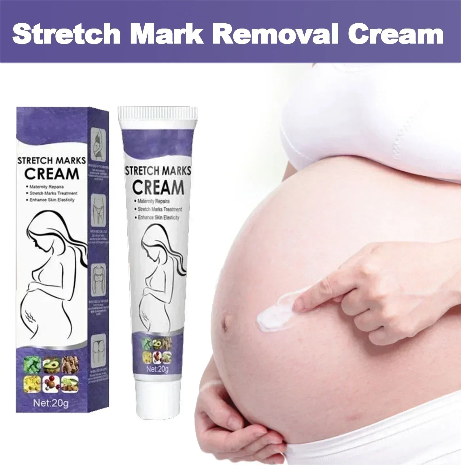 Krim penghilang Stretch Mark, krim perbaikan untuk wanita hamil, tanda obesitas, tanda pertumbuhan, kulit pengencang paha