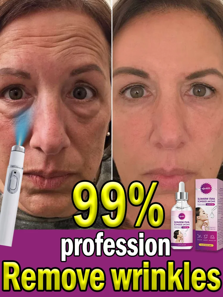 Laser Product To Solves wrinkle Problems