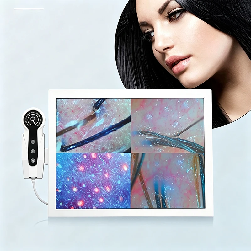 3 Hair Scalp Analyzer Triple Spectral Camera 10MP Resolution Skin Hair Detector Machine For Scalp Care Hair Loss Treatment Shop