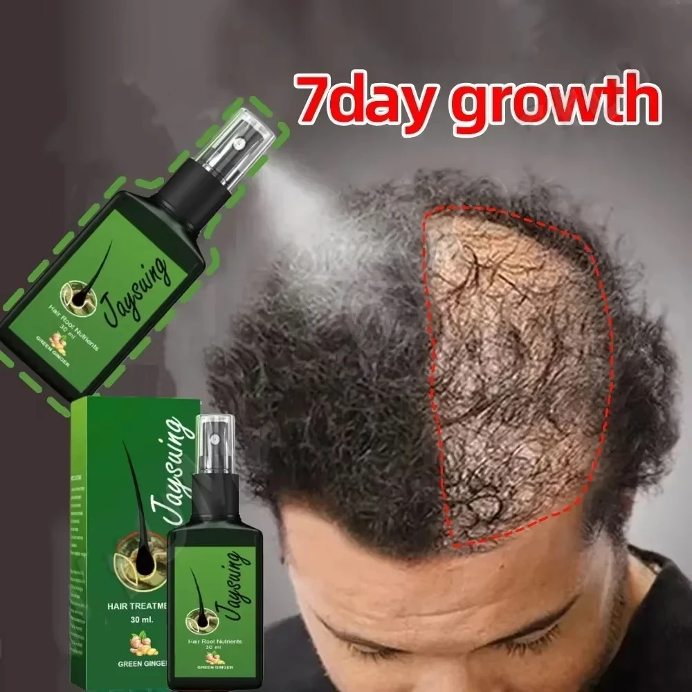 

Fast Hair Growth Serum Spray Anti Hair Loss Prevent Baldness Scalp Treatment Repair Roots Beauty Health Hair Care For Men Women