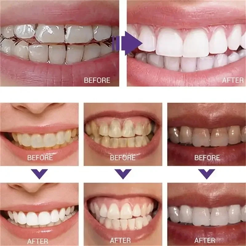Cleaning Tooth Whitening Serum Remove Plaque White Teeth Gel Teeth Yellow Smoke Stains Toothpaste Fresh Breath Oral Hygiene Care