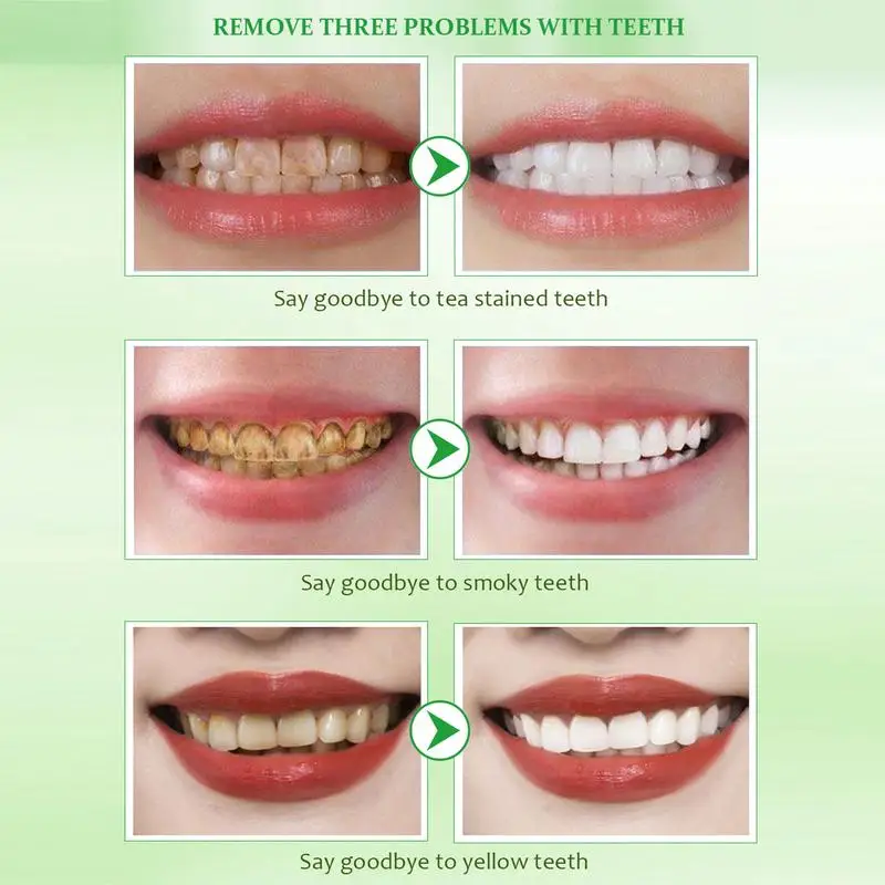 Esencia limpiadora de dientes rápida y efectiva, blanqueamiento bucal para dientes sensibles, tratamientos de lavado bucal