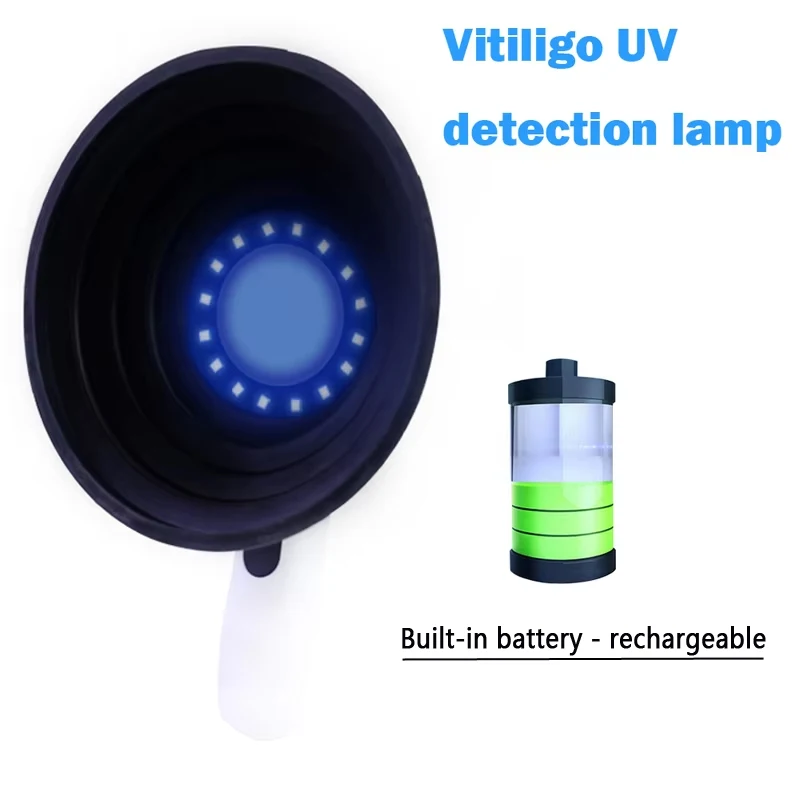 Huidanalysator met boslamp Draagbare vitiligo-detectoranalysemachine Led oplaadbare verlichting voor apparatuur voor thuisgebruik