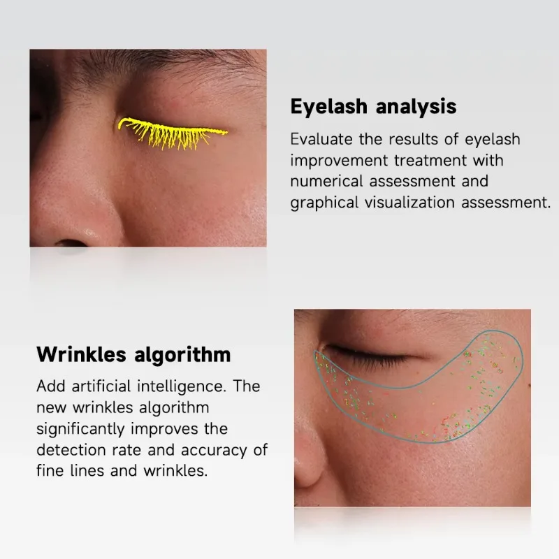 Máquina de análisis de piel 3D, Dermatoscopio AI, analizador de piel Facial, escáner Facial inteligente con luz UV para Spa, salón de belleza