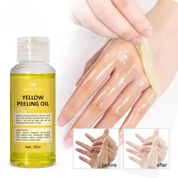 Óleo esfoliante amarelo clareador para a pele do corpo, remoção de descamação, pele morta, dilui melanina de mancha escura, cuidado hidratante