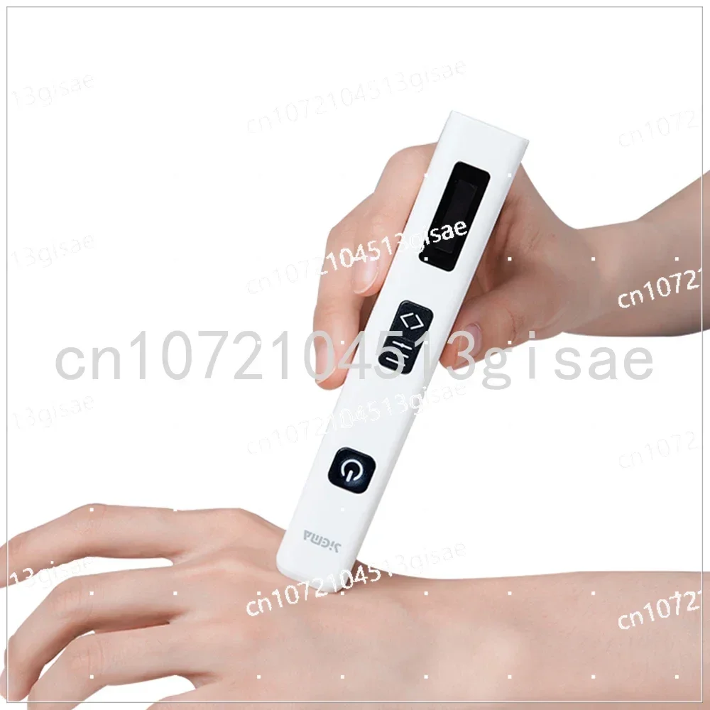 

SIGMA Wand Ace 308nm Excimer Laser UVB Phototherapy Device UV Light Lamp for Vitiligo Psoriasis