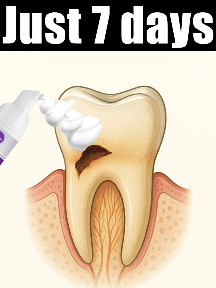 

Мусс для укрепления десен, уменьшения налета и бережного очищения полости рта, жидкость для гигиены полости рта