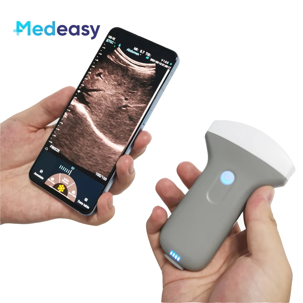Cheap 96 Element Convex Color Doppler Price Ultrasound Probe 3.5/5.0 MHz Wireless USB & Wifi Handheld Ultrasound Machine