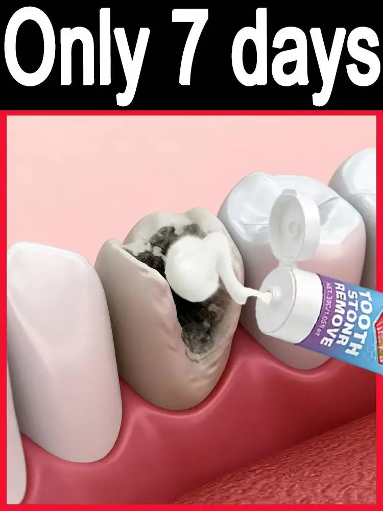 

Sᴄɪᴇɴᴛɪғɪᴄ ᴛᴏᴏᴛʜ ᴅᴇᴄᴀʏ ᴘʀᴇᴠᴇɴᴛɪᴏɴ, ᴘʟᴀᴏ̨ᴜᴇ ʀᴇᴍᴏᴠᴀʟ, ᴀɴᴅ ᴛᴏᴏᴛʜ ᴡʜɪᴛᴇɴɪɴɢ.Make your smile more confident