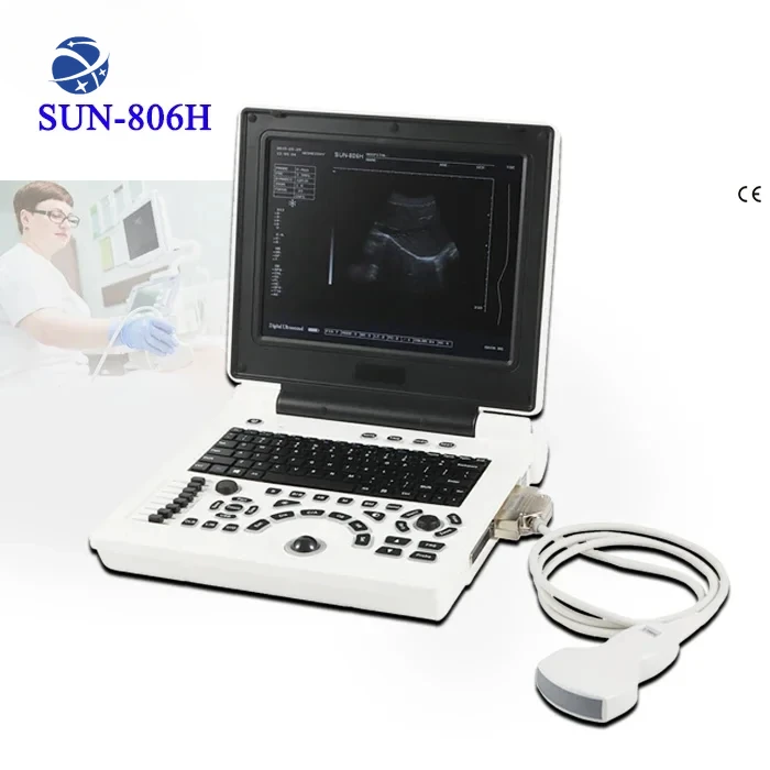 

SUN-806H Hot selling SunBright ultrasound machine for animals with high quality