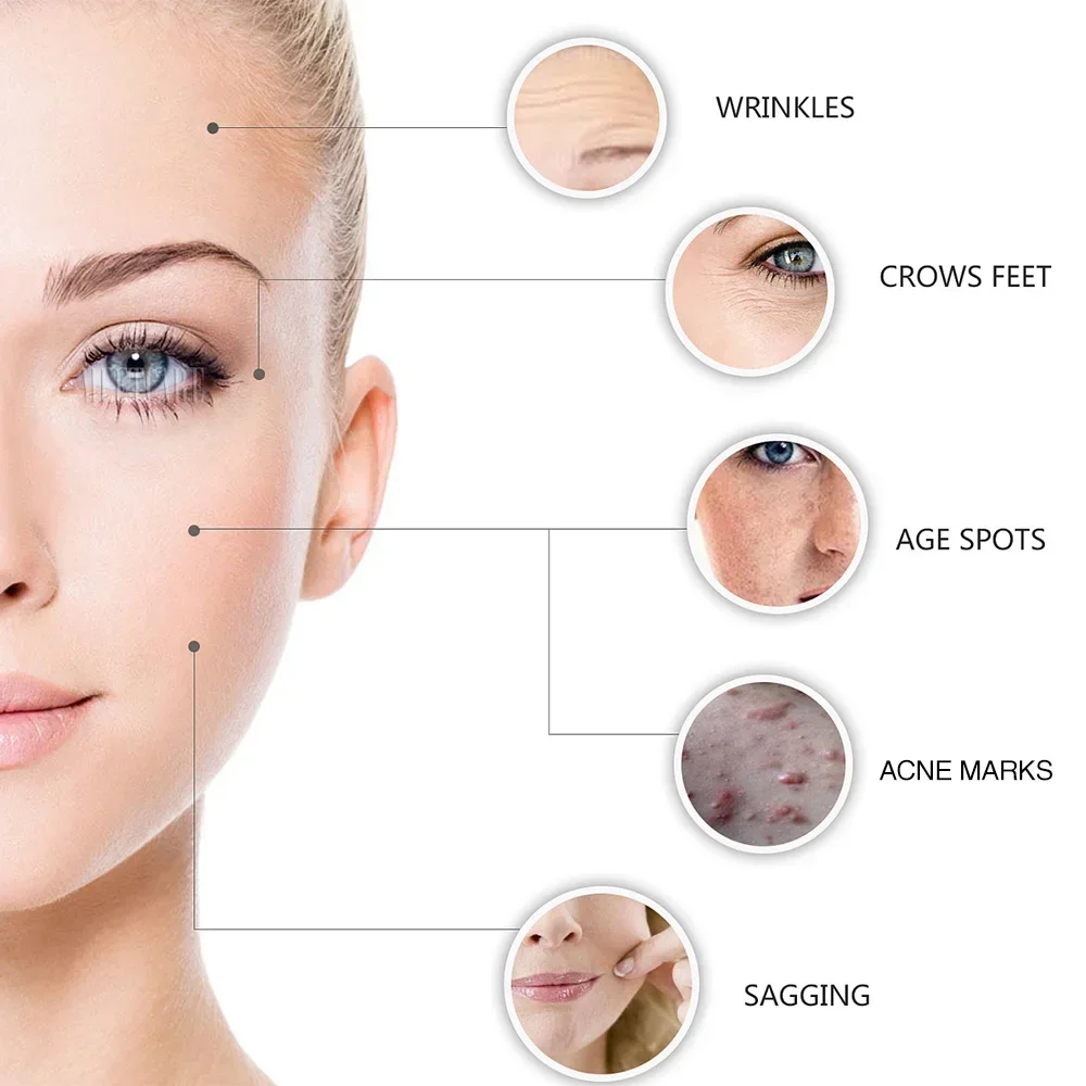 Microaguja de agua desmontable con rodillo de 64 agujas, adecuada para esencia facial de vitamina C de ácido hialurónico de oro de 24 quilates