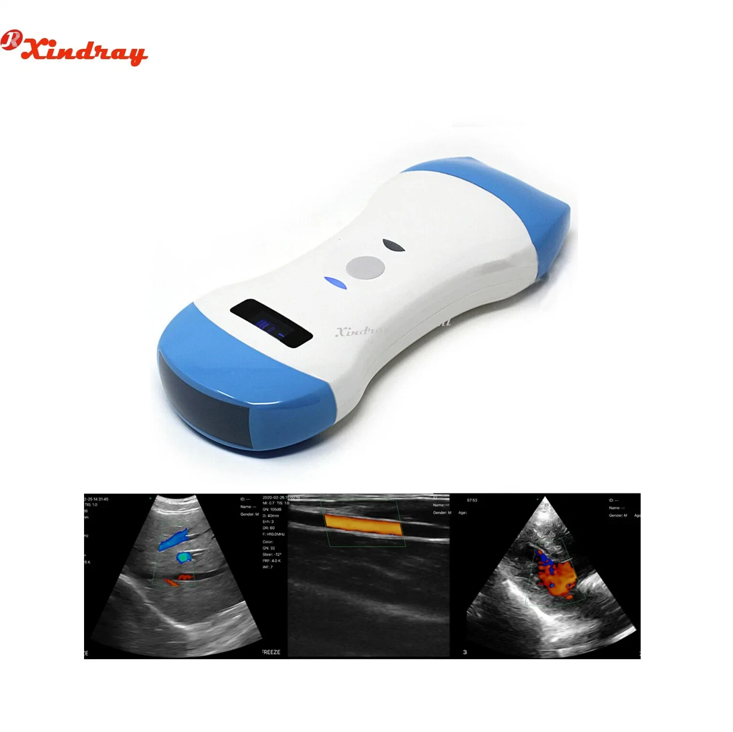 Medical Products CE Marked Medical Ultrasound Scanner with Wireless WIFI System Control for Diagnosis Clearly Scan