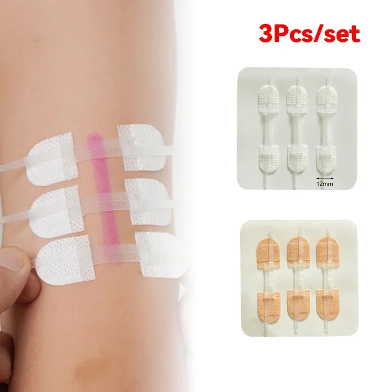 Wound  Closure Strips  Wound Repair  Strip Adhesive Medical Suture Free Surgical Tape