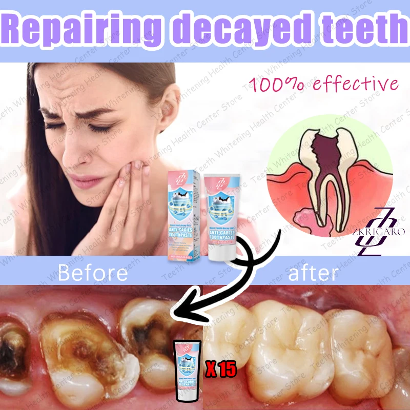 Repair black spots and remove tooth decay