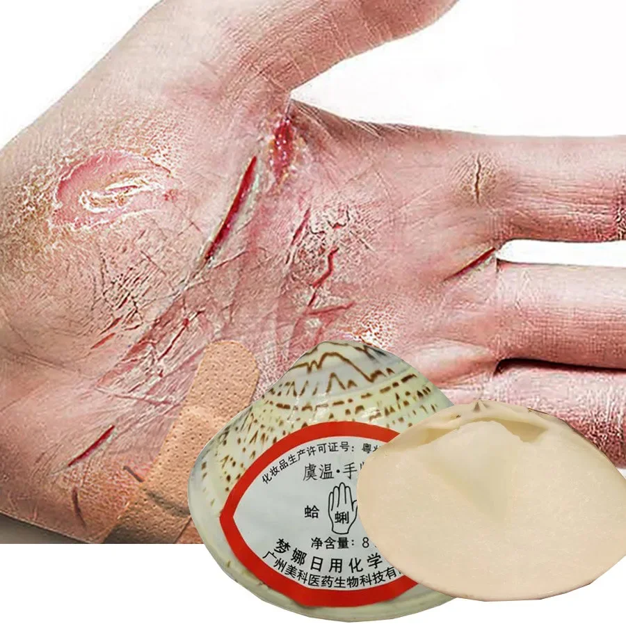 

Traditional Chinese Clam Oil Anti-Drying Crack Foot Moisturize Cream Hand Heel Cracked Repair Removal Dead Skin Callus Care Mask