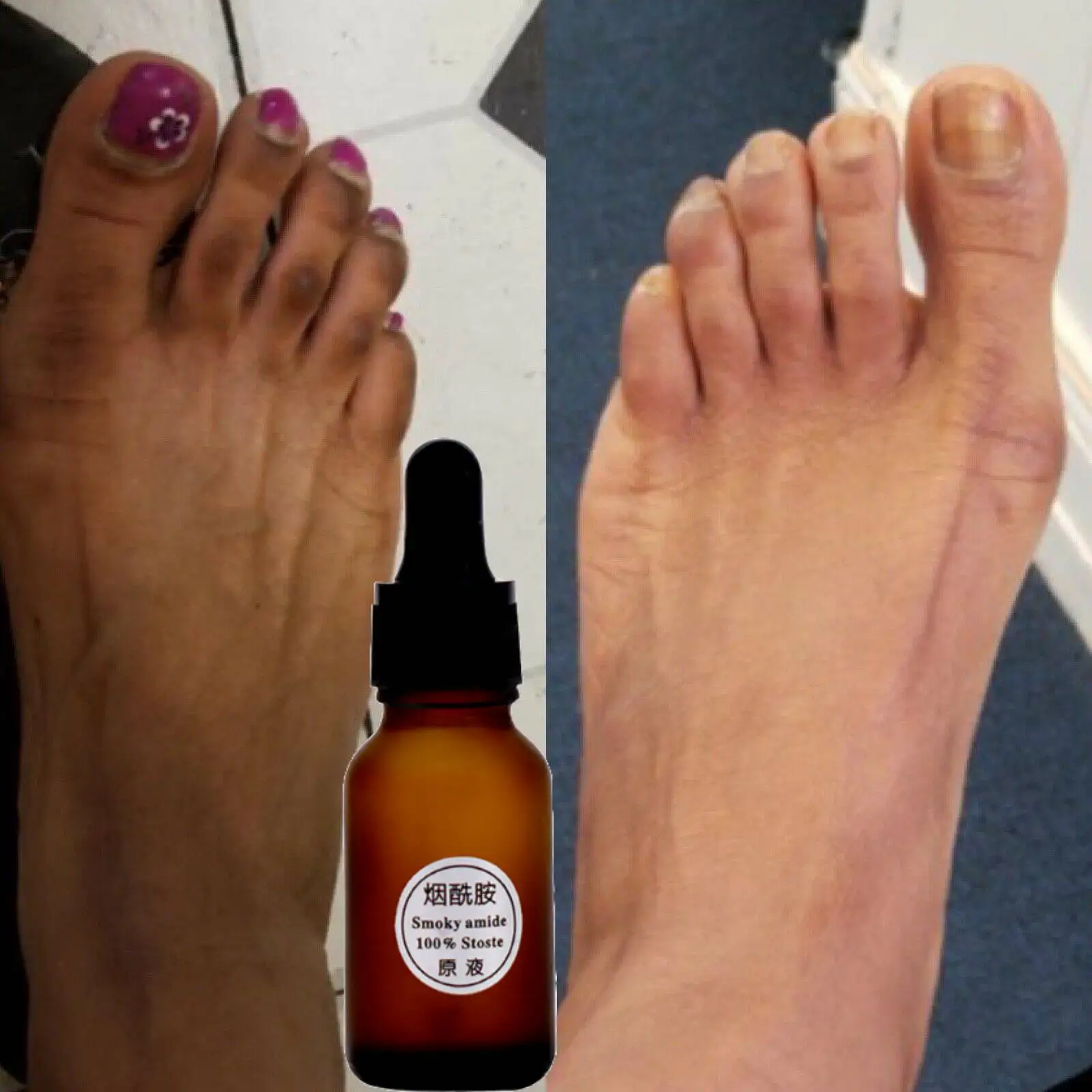 Dark Knuckles in Feet: The Real Solution Behind This Intense Whitening Oil Cream