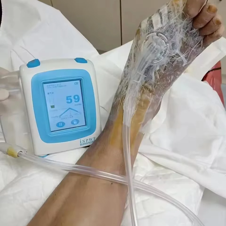 

Кабина для взвешивания отрицательного давления Насос для терапии ран отрицательного давления Система дренажа ран отрицательного давления